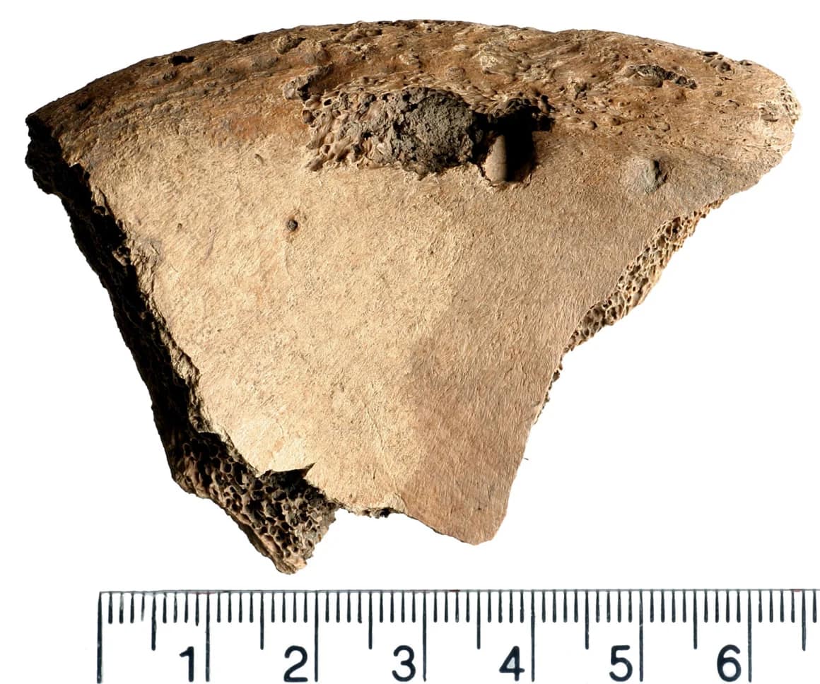 Bite marks can be seen on the man's pelvis.