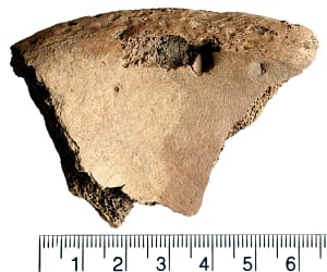 Bite marks can be seen on the man's pelvis.